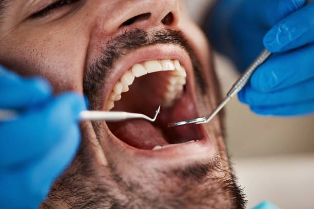 Best Pediatric Emergency Dentist in Leesville, LA